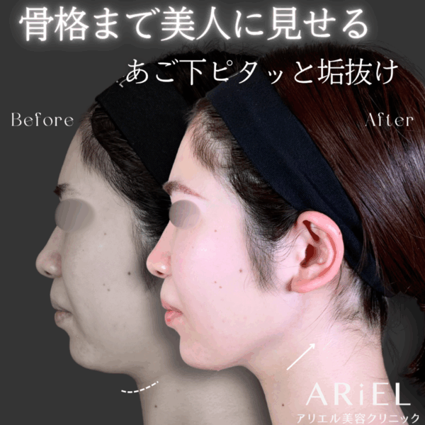 No.9209の症例写真